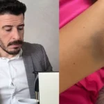 Título: calvo do campari: agressão confessa abalda futuro do influencer