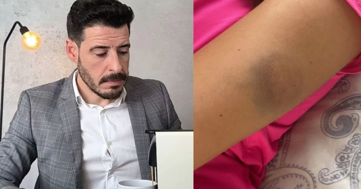 Título: calvo do campari: agressão confessa abalda futuro do influencer