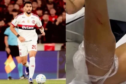 Com ancelotti em alerta nas tribunas, lucas paquetá escapa de